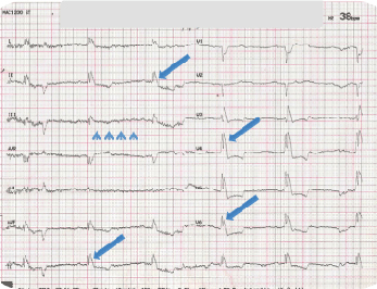 accr id1007