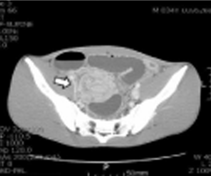 ajs-v6-id1157-g001